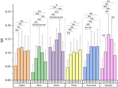 Effects of gender and age on sleep EEG functional connectivity differences in subjects with mild difficulty falling asleep